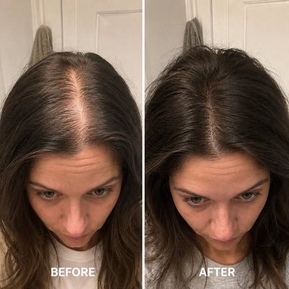Deoxyribose Scalp Serum | For Fuller-Looking Hair