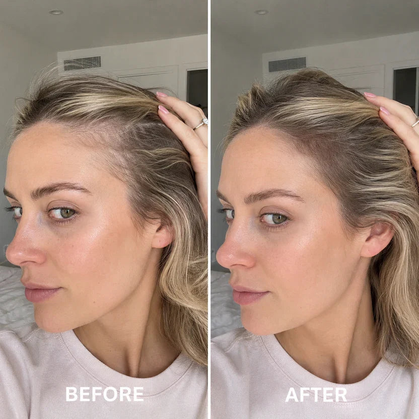 Deoxyribose Scalp Serum | For Fuller-Looking Hair