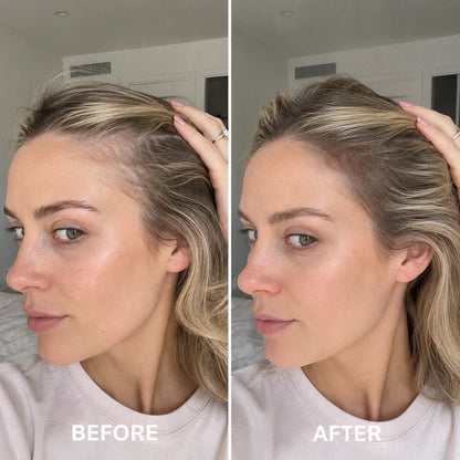 Deoxyribose Scalp Serum | For Fuller-Looking Hair