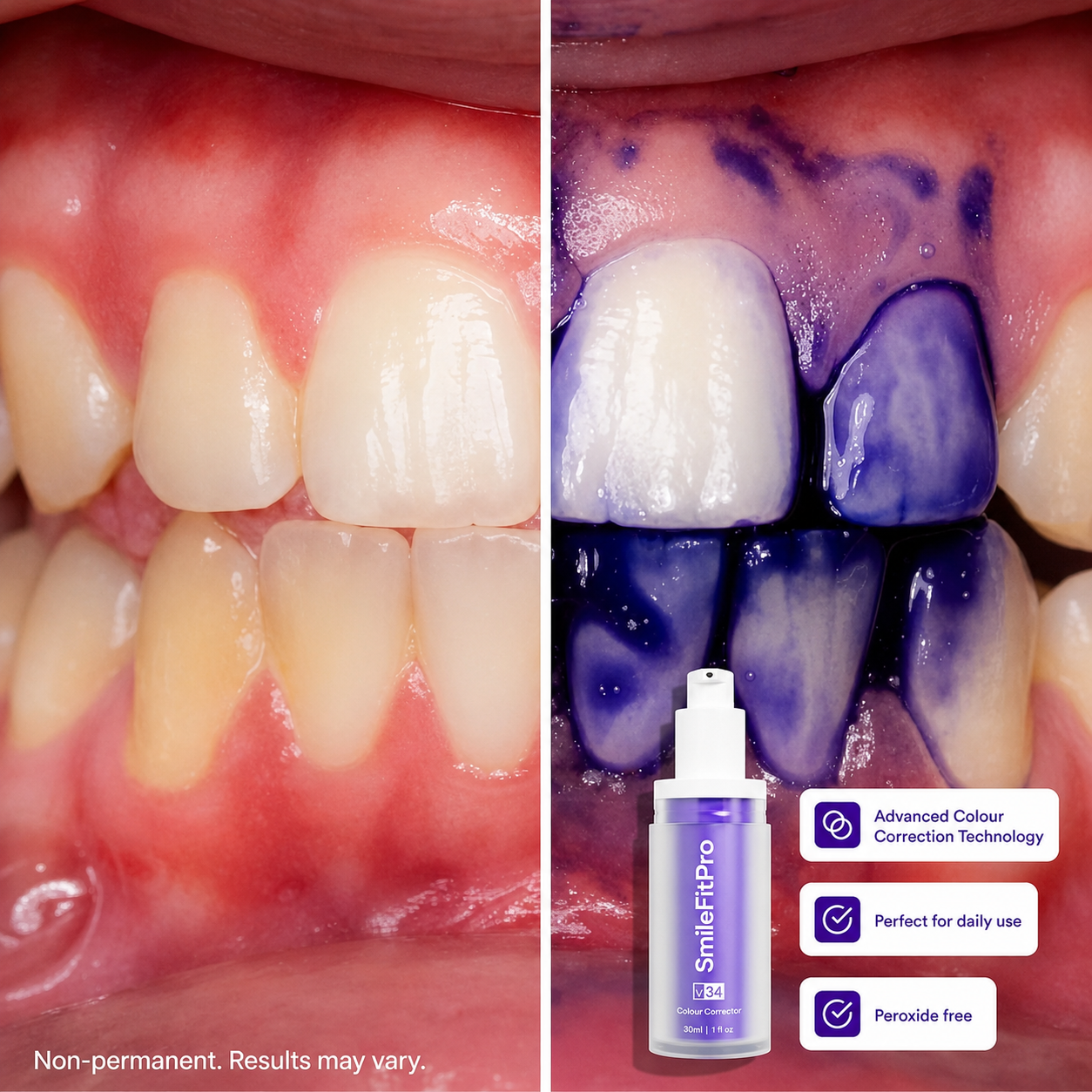 V34 Instant Teeth Whitening Colour Corrector Serum